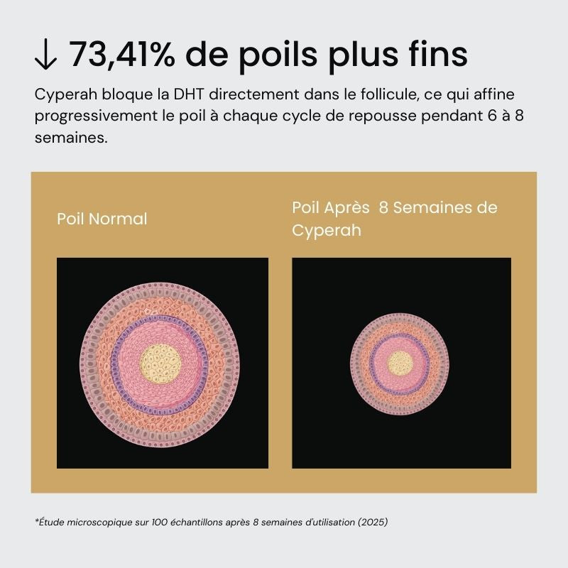 Cyperah™ - Sérum Réducteur de Repousse